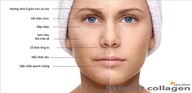 Dấu hiệu lão hóa da -SkinLift collagen chống lão hóa da