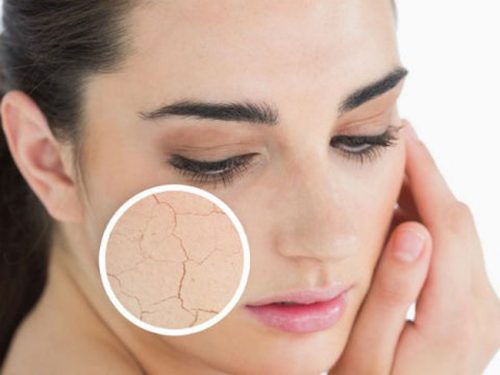 Hiện tượng của da khô là dấu hiệu của lão hóa da-skinLift collagen