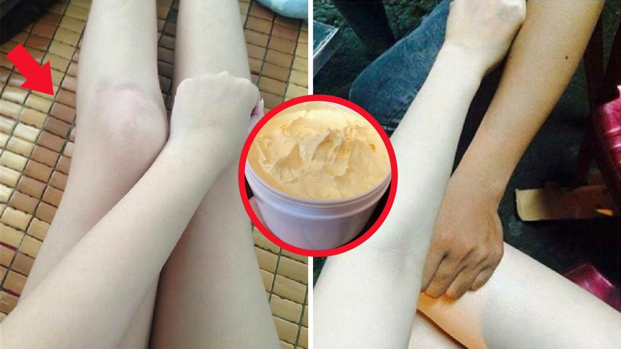 5 tác hại của kem trộn với da không phải ai cũng biết