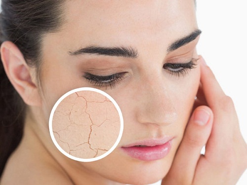 Bạn đã biết làm thế nào để có da mặt đẹp tự nhiên không khô sần