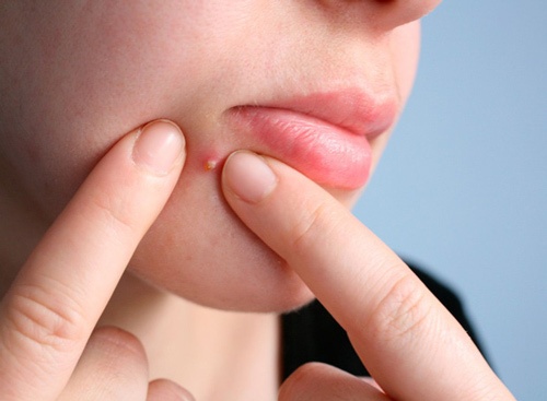 Chăm sóc da mặt nhờn có khó không? Những điều cần lưu ý