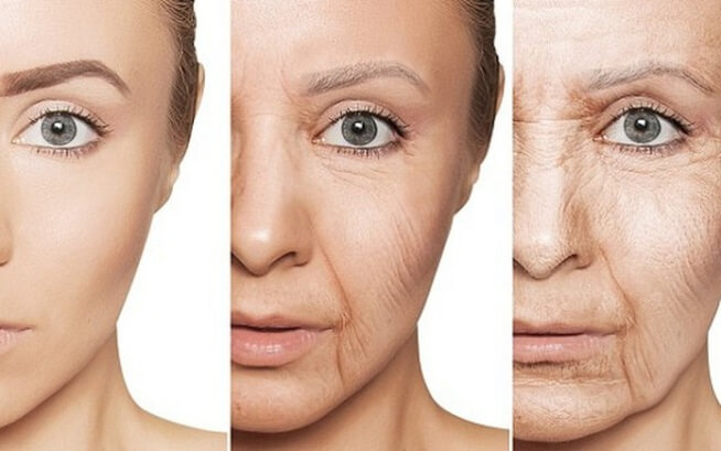 Uống collagen làm đẹp da có gây nổi mụn không?