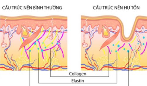 Collagen có tác dụng giúp trẻ hóa da không? Giá collagen trẻ hóa da?