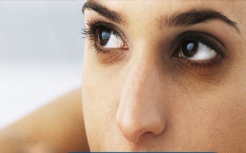 Liệu bạn đã biết cách trị quầng thâm mắt tại nhà đúng cách?