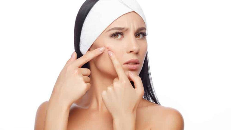 Cẩm nang chăm sóc da: cách trị mụn bọc và thời điểm tốt để nặn mụn