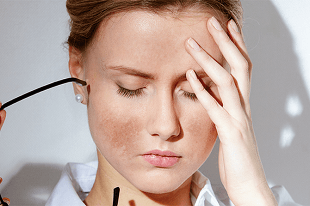 Bạn đã biết tác hại thức khuya đối với làn da của mình là gì chưa?
