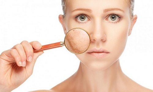 Cảnh báo da bẩn có hại như nào? Cách làm sạch da hiệu quả tại nhà