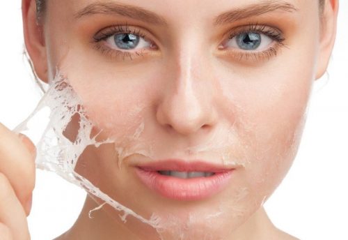 Peel da là gì? Bạn nên và không nên làm gì khi peel da tại nhà?