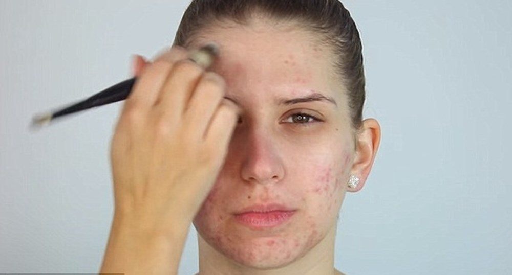 Tip chăm sóc da đúng cách giúp làn da đẹp không mụn