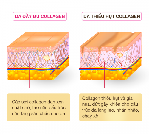 Tại sao bạn cần nhanh chóng cải thiện da bị đứt sợi collagen ở tuổi 30