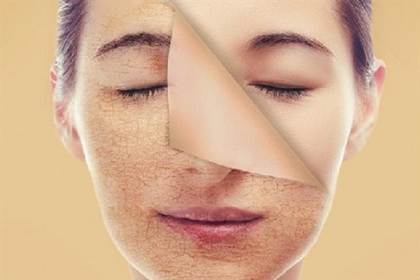 Vì sao da mặt nhợt nhạt kém sắc ở tuổi 20 bạn đã biết?