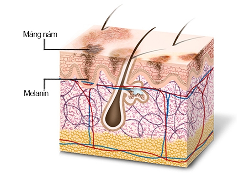 Mách bạn cách đào thải melanin giúp da trắng sáng, đều màu hơn