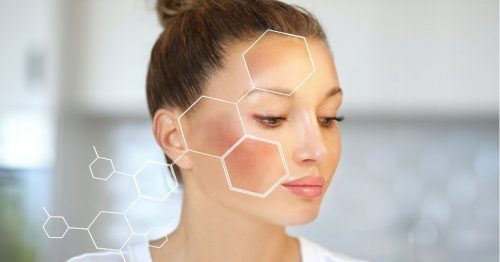 Giải đáp thắc mắc điều trị nám bằng collagen có hiệu quả hay không?