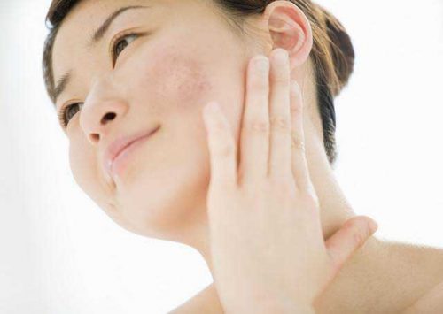 Cập nhật chu trình chăm sóc da mặt bị nám hàng ngày hiệu quả