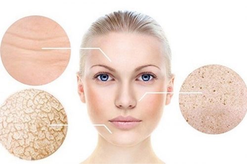 Giúp bạn phân loại collagen cho da? Bạn nên chọn collagen loại nào?