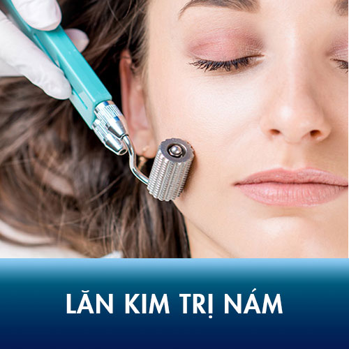 Góc giải đáp: Liệu da nám có nên lăn kim hay không?