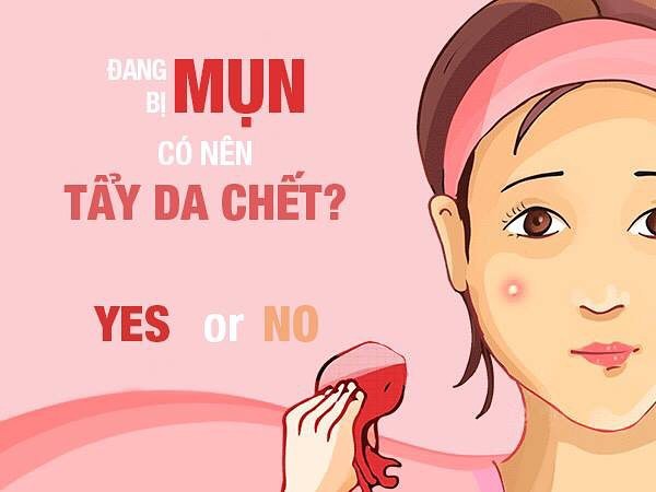 Những chú ý bạn cần biết khi tẩy tế bào chết cho da mụn