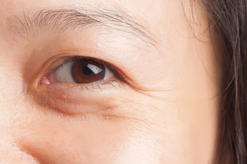 Bạn có biết nguyên nhân vùng da mắt bị lão hóa sớm ở tuổi 30?