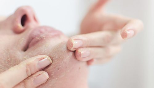 Những mẹo giúp giữ ẩm cho da vào mùa đông cho tuổi 50