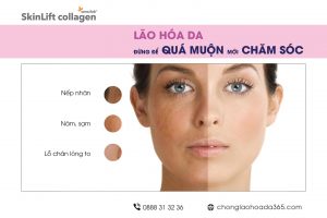 dung de qua muon moi cham soc da _skinliftcollagen_chonglaohoada