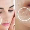 Bí quyết chăm sóc da mặt đúng cách cho người có làn da khô