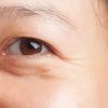 7 tuyệt chiêu giúp trẻ hóa vùng mắt tuổi trung niên hiệu quả nhất