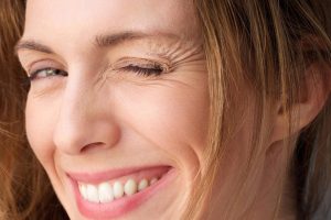 Tại sao có vết nhăn mắt khi cười? Cách cải thiện hiệu quả