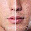 Da mặt sạm đen ở nam giới – Làm sao để cải thiện?