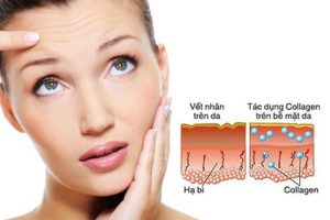 Những kiến thức về collagen bạn cần biết trước khi sử dụng