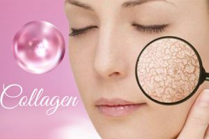 Giải đáp thắc mắc da khô nứt nẻ uống collagen có tốt không?