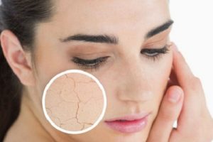 Giải đáp thắc mắc uống collagen trị khô da có hiệu quả không?