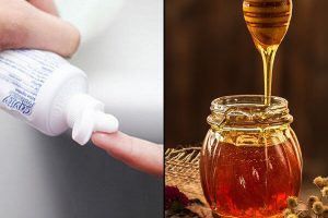 Trị nám bằng mật ong và kem đánh răng có hiệu quả không?