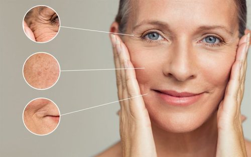 Phụ nữ tuổi 40 ngăn chặn lão hóa da như nào để da sáng mịn?