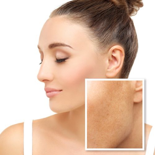 Các bước skincare cho da không đều màu ở tuổi 30 đơn giản tại nhà