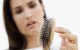 Tình rạng rụng tóc ở tuổi 50 - Nguyên nhân và giải pháp khắc phục