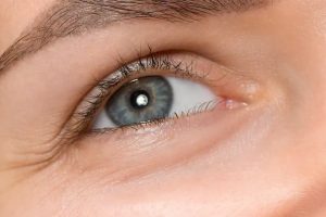 Nếp nhăn ở mắt sau sinh: Nguyên nhân và cách cải thiện hiệu quả