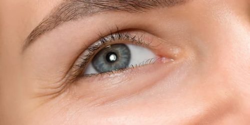 Nếp nhăn ở mắt sau sinh: Nguyên nhân và cách cải thiện hiệu quả