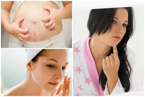 Những cách giúp làm đẹp khi mang thai đơn giản cho da rạng rỡ