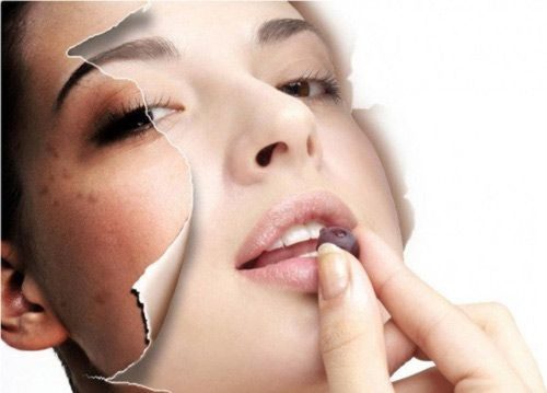 Giải đáp thắc mắc uống collagen trị mụn cho tuổi 30 có hiệu quả không?