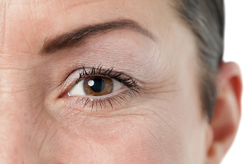 Giải pháp giúp bạn giảm nếp nhăn sâu vùng mắt tuổi 40 tại nhà